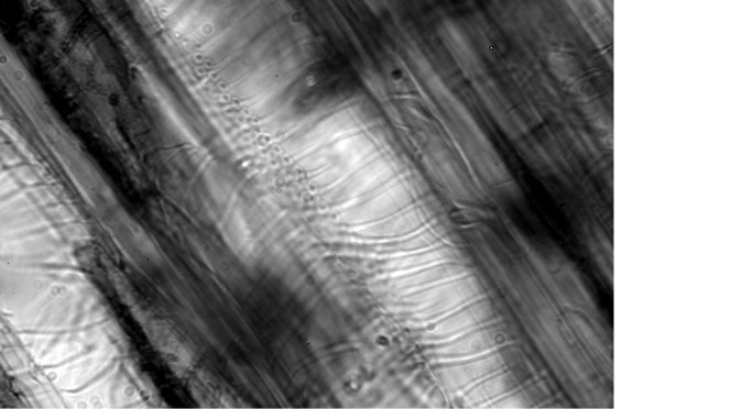 zgrubienia spiralne w powiększeniu